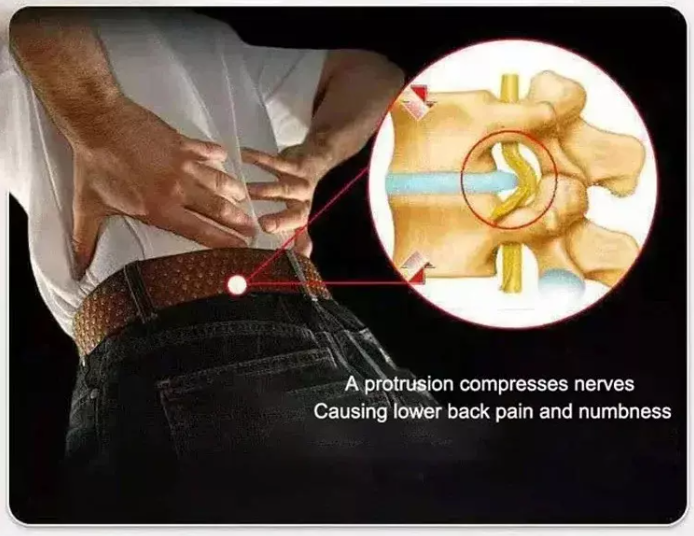 Pack ( 2 boxes ) Ointment for back pain